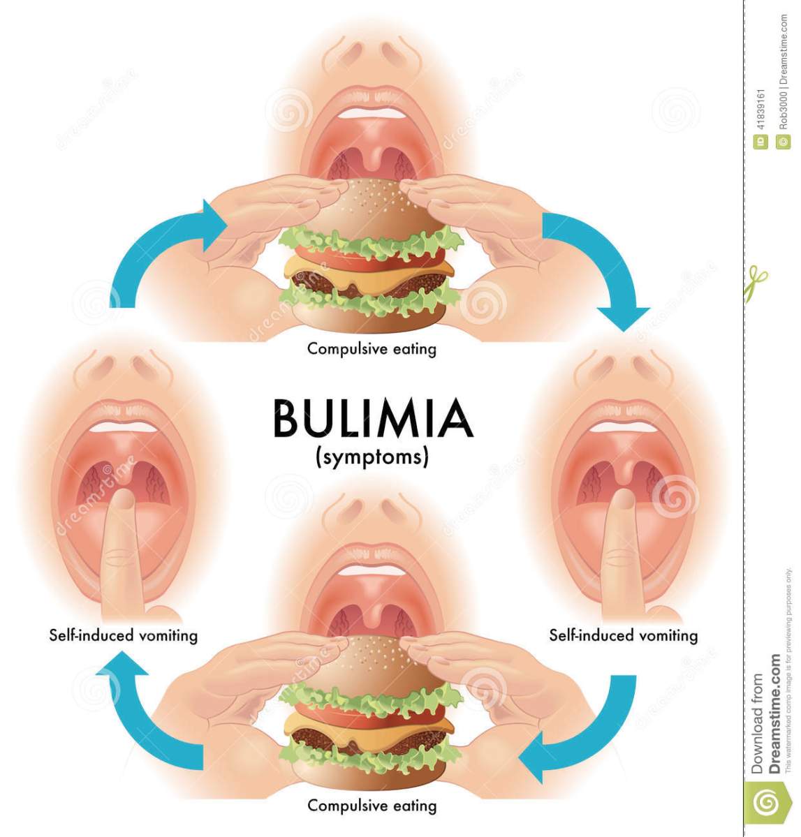 bulimia-bergen-county-nj.jpg?w=1147